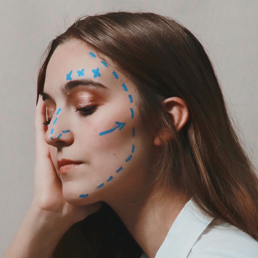 MLD after cosmetic surgery